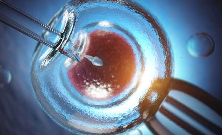 IVF – In-vitro fertilisation